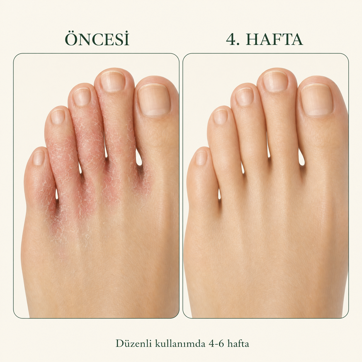 Oncesi ve 4. hafta